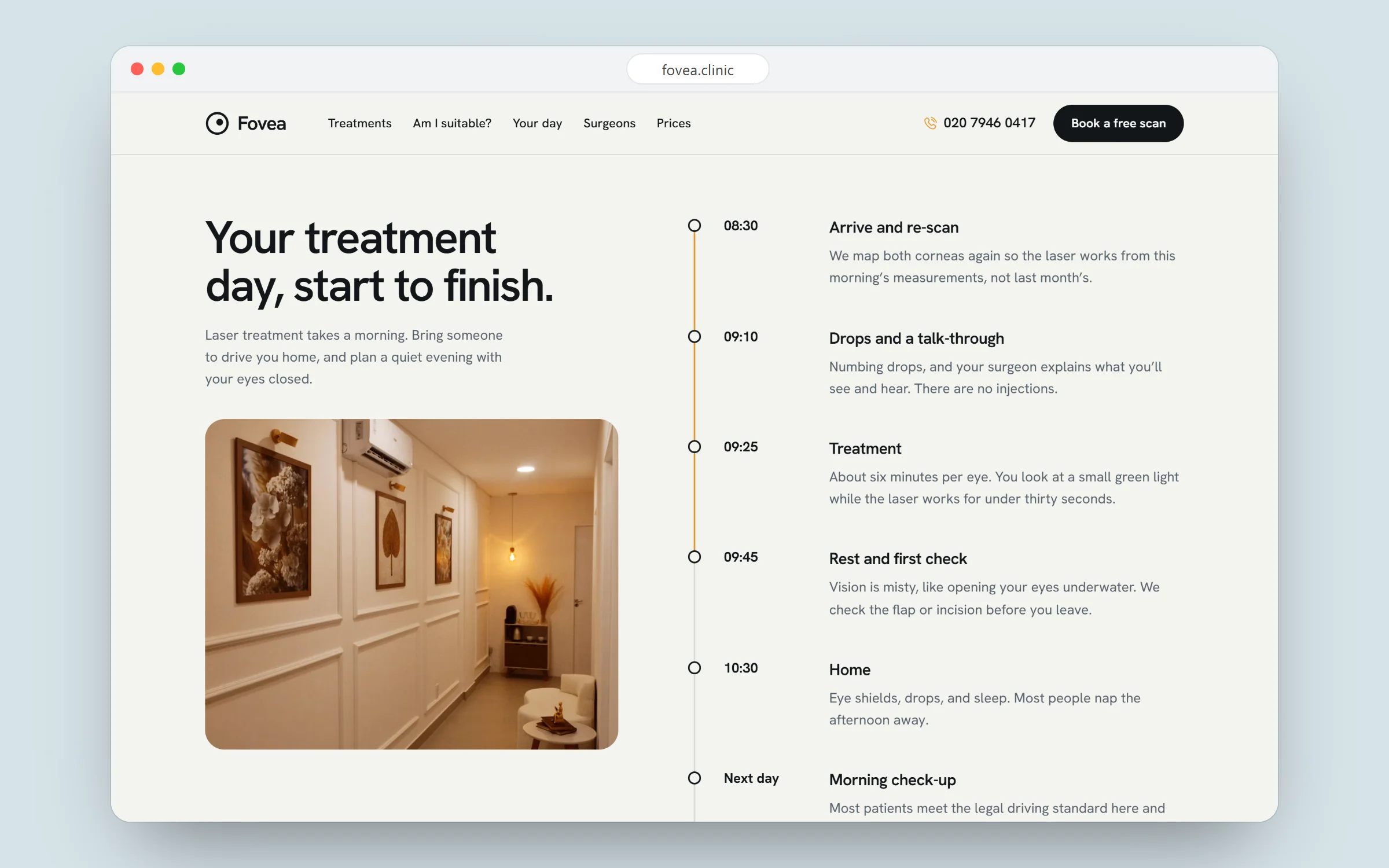 Fovea: Your treatment day